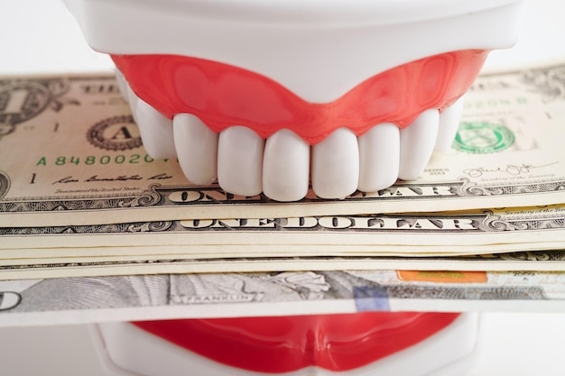 86 000 Dental Expenses Pictures